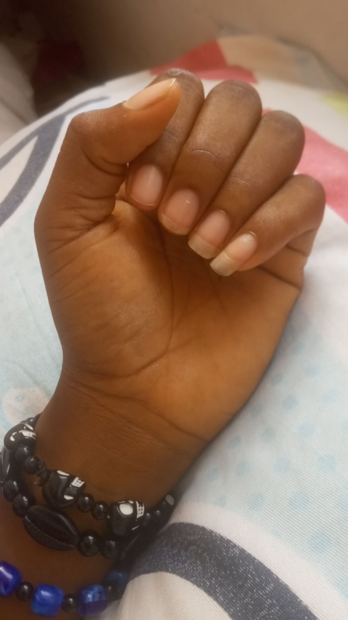 Can I Be A Hand Model Wdyt And Any Suggestions?
