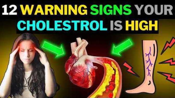 Do you know the 10 signs of high cholesterol?
