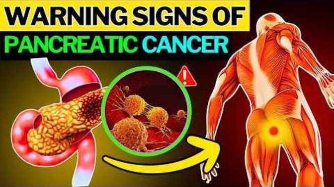 Do you know what the 12 signs of pancreatic cancer are?