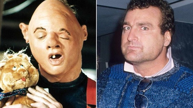 Do you need plastic surgeries to have better odds on dating?