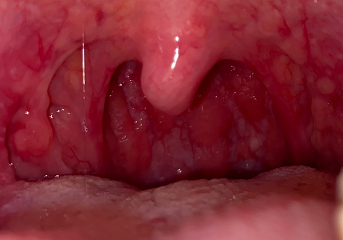 Why is my throat like this?