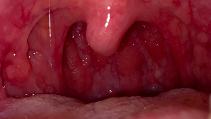Why is my throat like this?