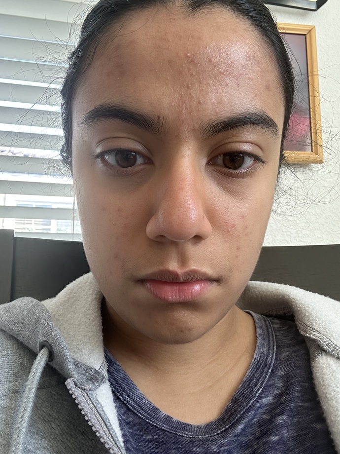 What makeup would make me pretty?
