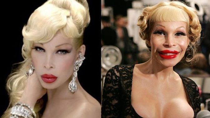 Would someone with a lot of plastic surgery on their face be repulsive to you?