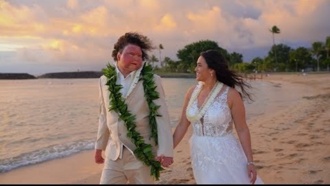 What do you think of this face and hands transplant wedding?