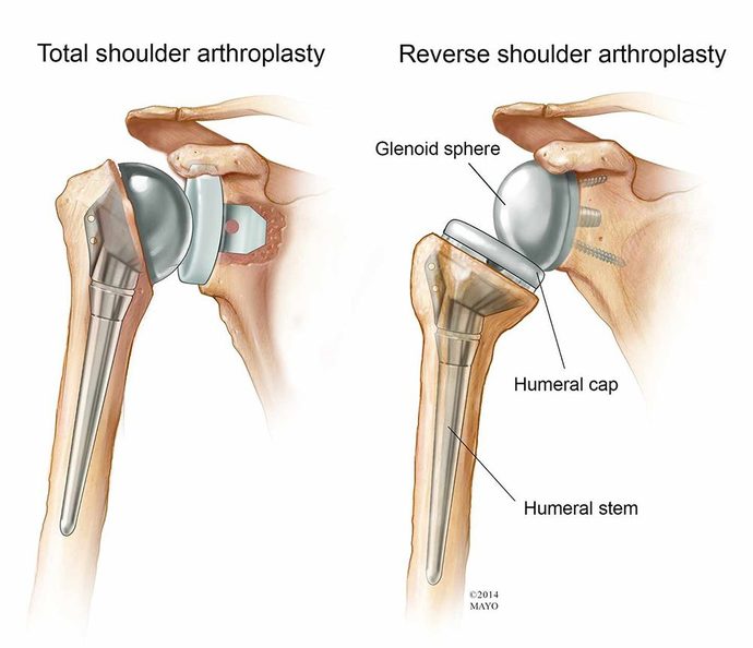 If you could, what body part would you like to replace on yourself?