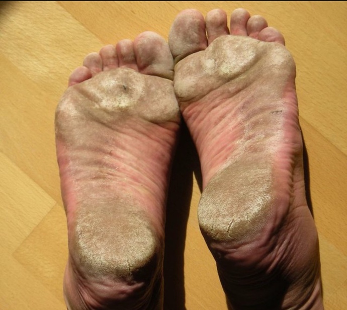 Would you lick crusty toes for $100,000?