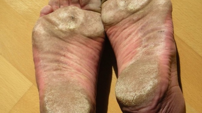 Would you lick crusty toes for $100,000?