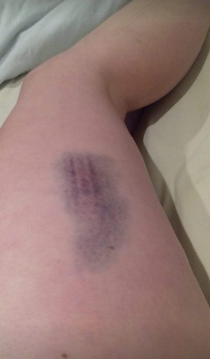 Girls, What is the best way to cover a scratch or small bruise on my legs?
