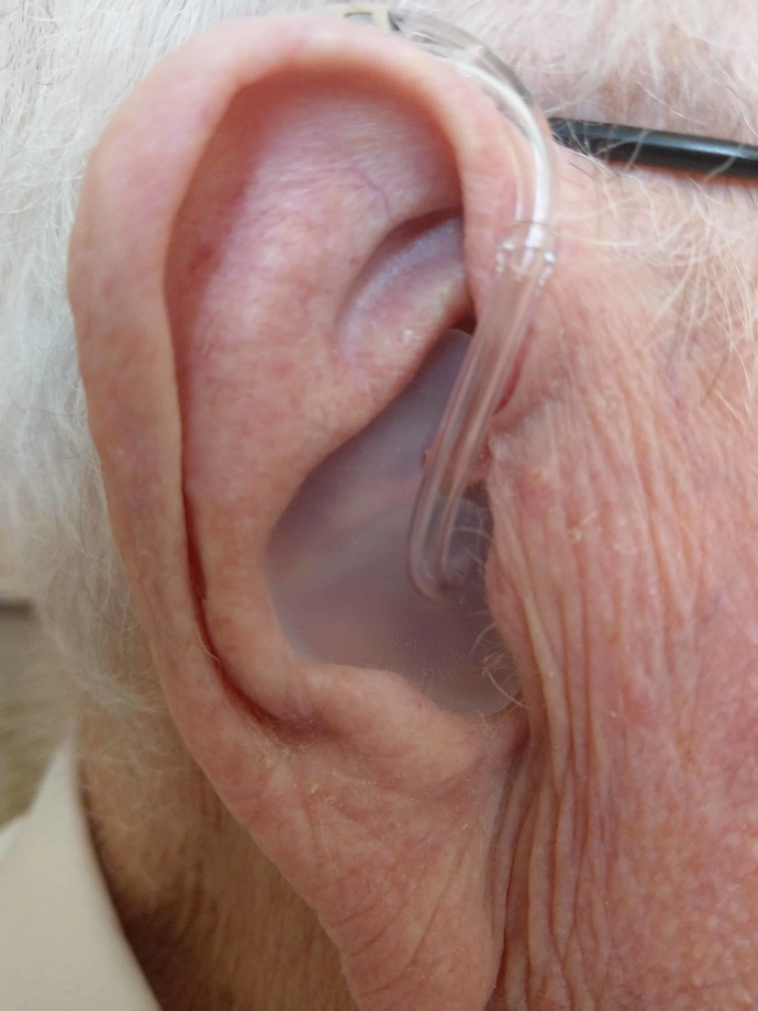 Girls, Would it be a turn off if a guy had hearing aids that look like this?