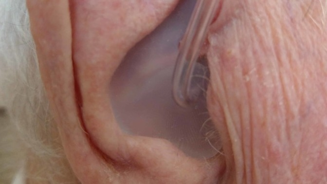 Girls, Would it be a turn off if a guy had hearing aids that look like this?