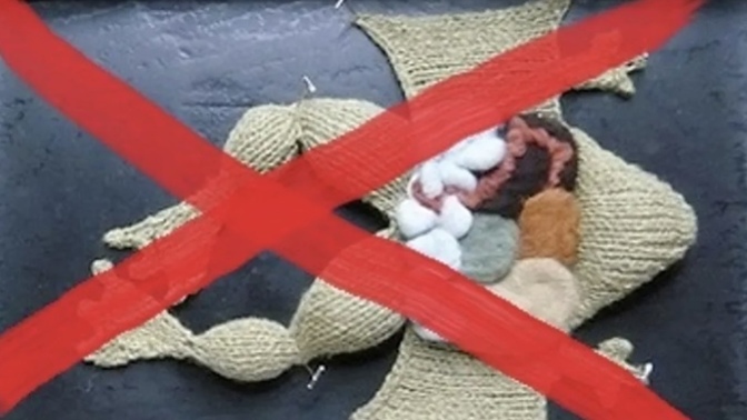 Should dissection of lab raised animals be banned from Schools/Colleges?