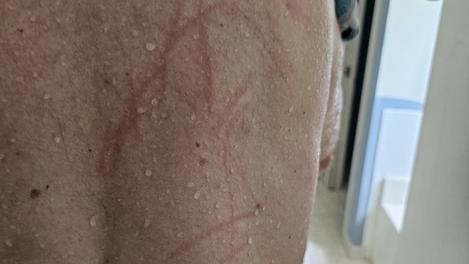 What are these scratches?
