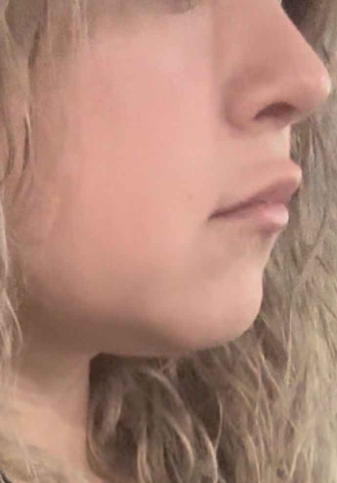 Can you guess what age someone is by their face and necks?