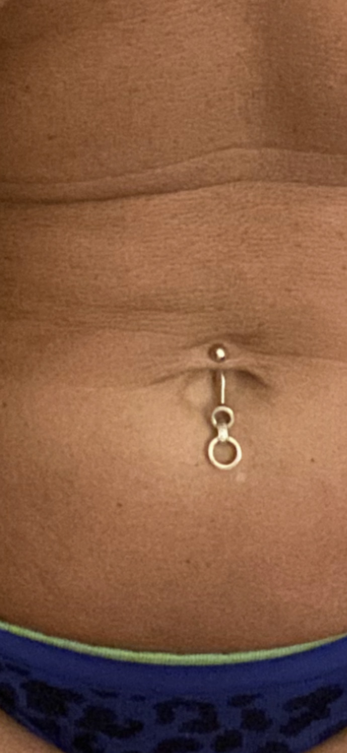 I have my ears pierced and my nose plus my belly piercing. What piercing do you have?