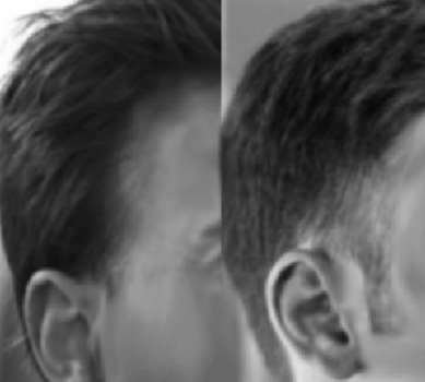 Which sideburn type looks more attractive?