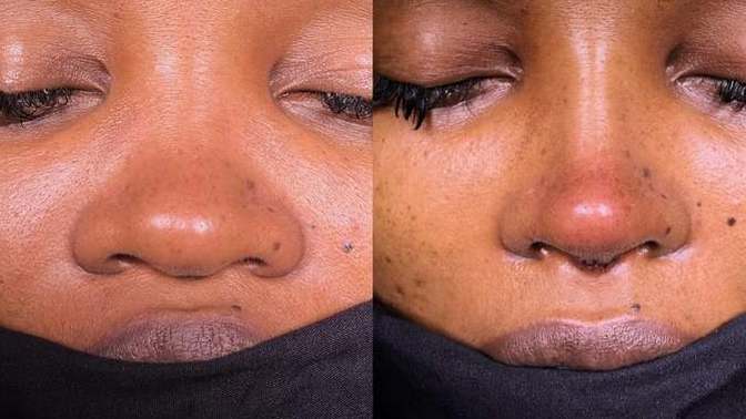 Do you agree nose is the most impactful feature?