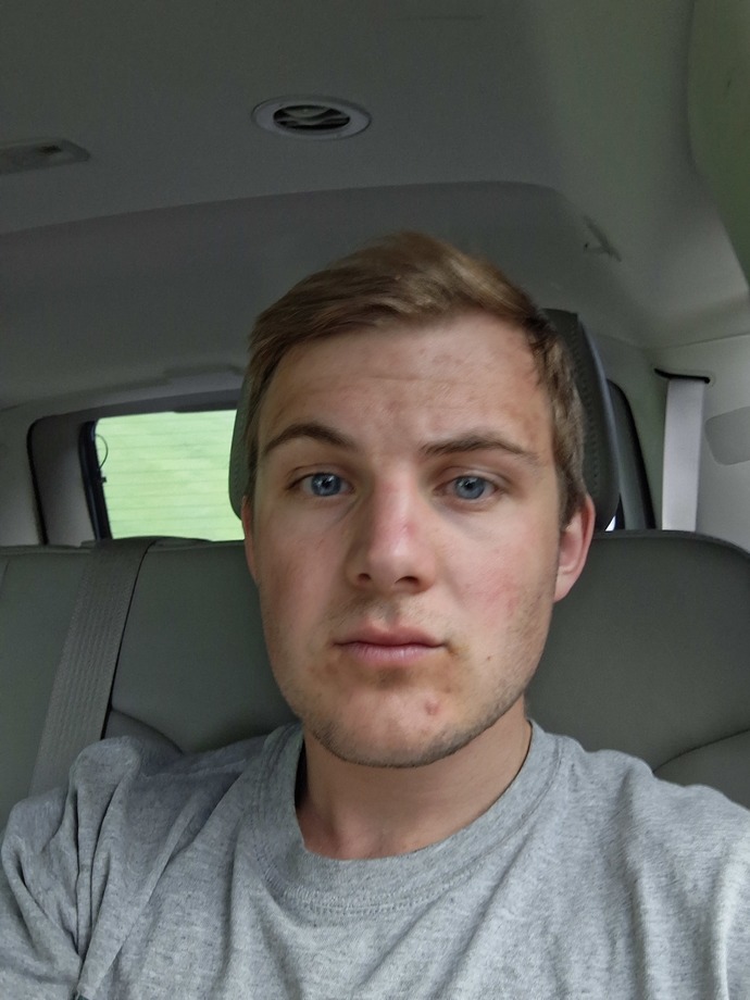 I honestly need to know. Is it because im ugly that I get no likes on dating apps?