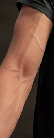 Are arm veins attractive or gross?