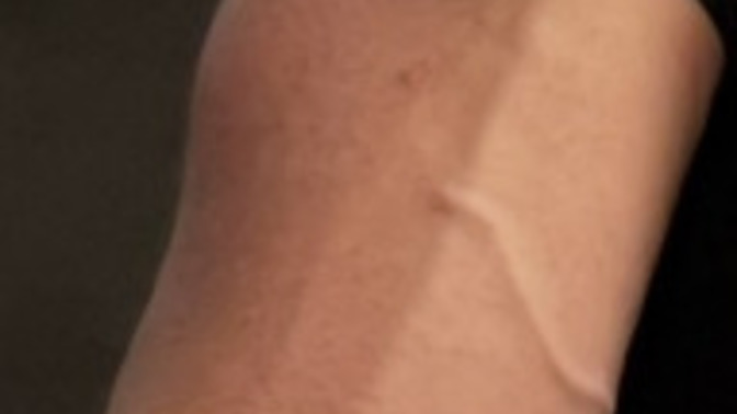 Are arm veins attractive or gross?