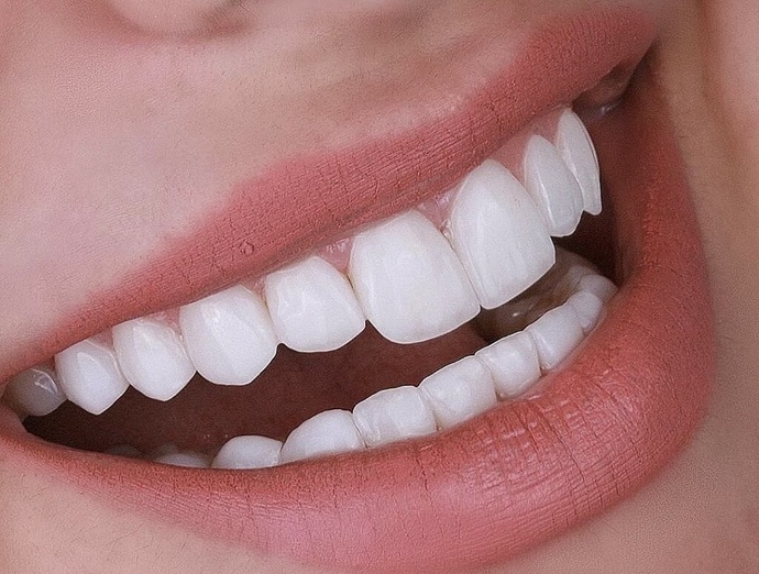 Do someones teeth matter to you when you are dating?