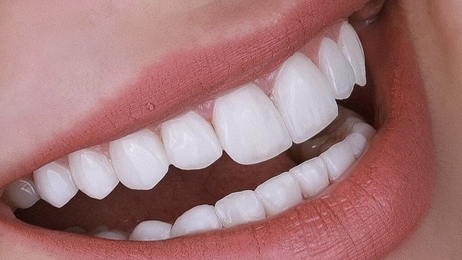 Do someone's teeth matter to you when you are dating?