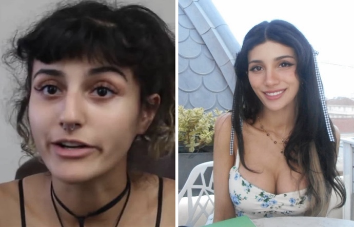 Which woman has better plastic surgery?