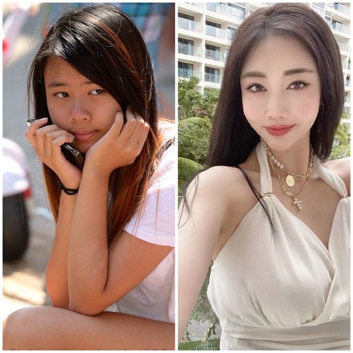 Which woman has better plastic surgery?