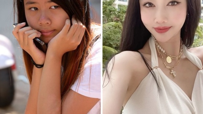 Which woman has better plastic surgery?