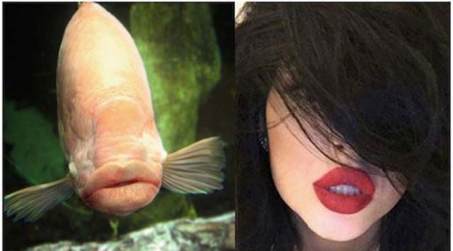 Why do girls think lip filler looks good?