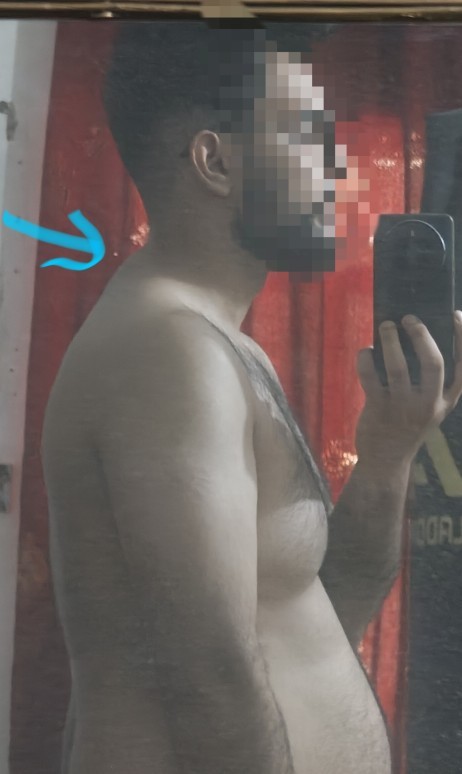 Back neck pain during lifting? Should I visit a doctor?