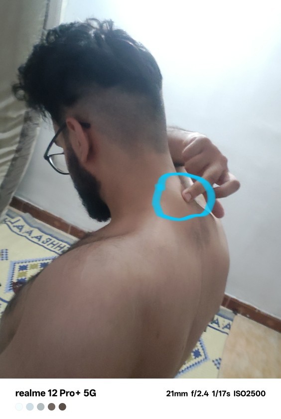 Back neck pain during lifting? Should I visit a doctor?