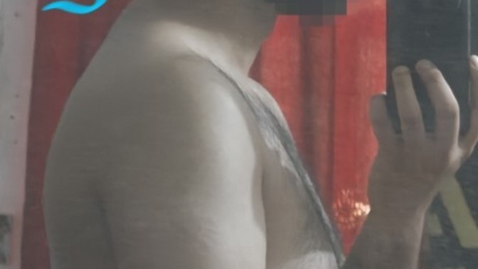 Back neck pain during lifting? Should I visit a doctor?