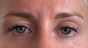 Does anyone actually find uneven/asymmetrical eyelids okay or attractive?