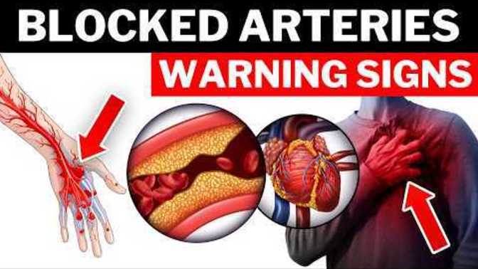 Top Signs Of Blocked Arteries You're Ignoring. Do You Want To Know What These Signs Are?