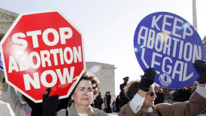 "Being Pro-Life Is About Protecting Life, Not Controlling Women, And Being a Man Doesn’t Mean Your Opinion Shouldn't Matter." Agree or Disagree?