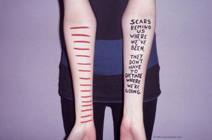 Do you have scars?