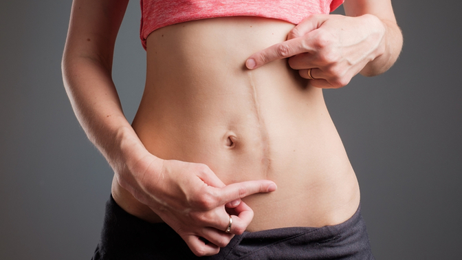 Do you have scars?