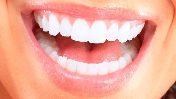 Do you have HEALTHY TEETH?