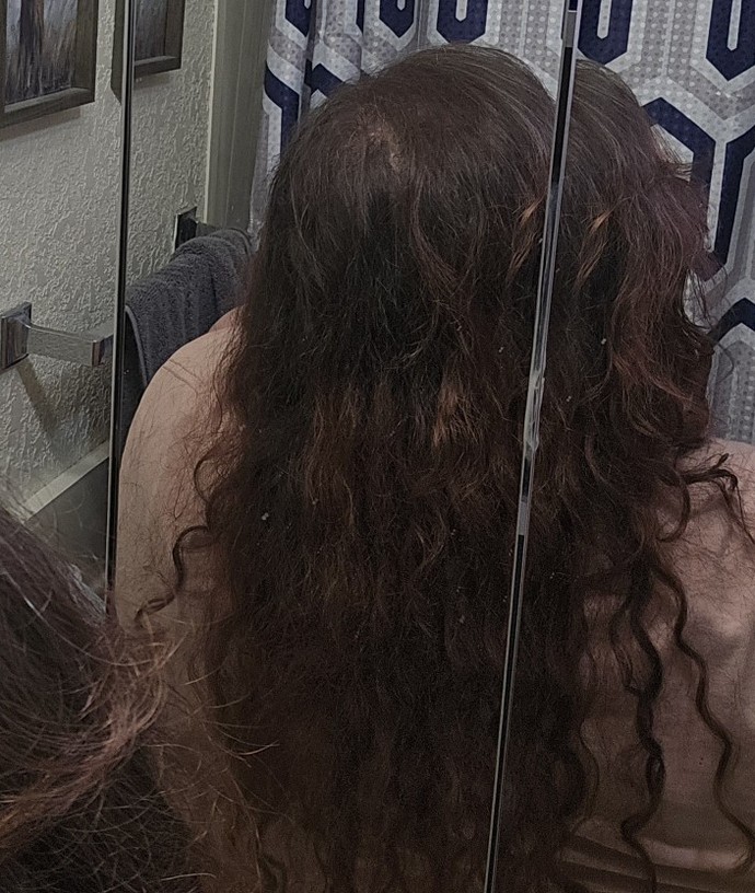 I think Im balding?