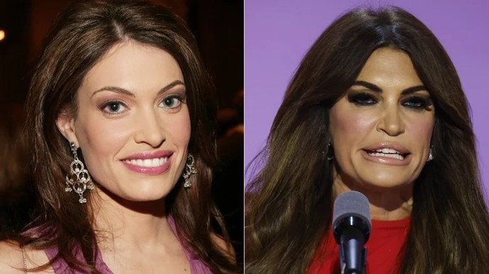 Kimberly Guilfoyle - before and after