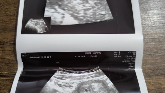 My baby's sac was visible. On July 12th, I found out I was 35 days pregnant, and now I am 40 days pregnant. Who is the family that completes your sou?