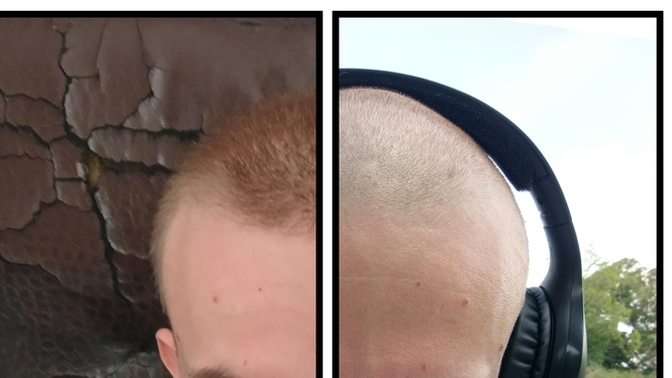 What do you use for hair growth?