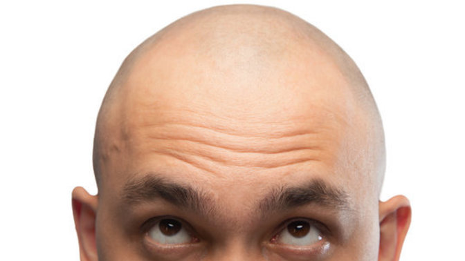 Why is bald considered weird in society?