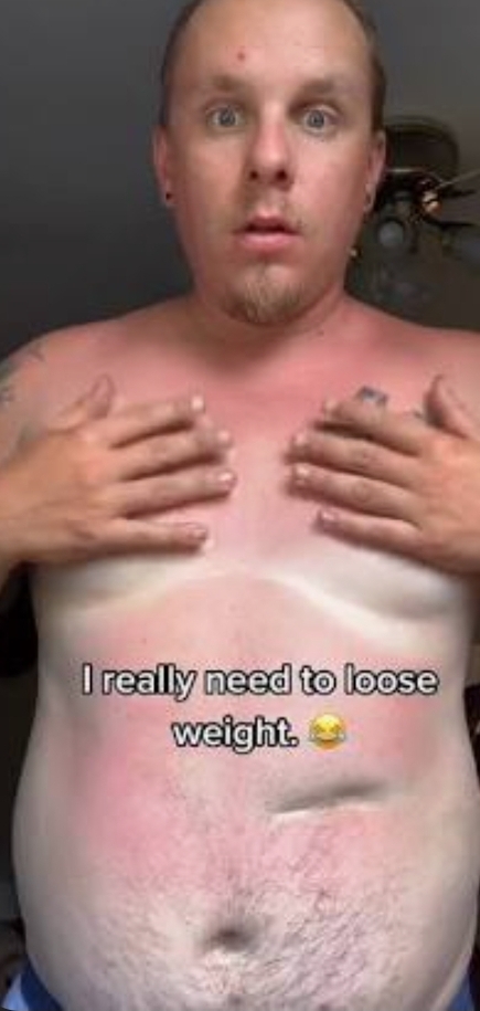 Girls, Guy with moobs large enough for no tan? Whats your reaction ladies?