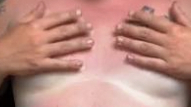 Girls, Guy with moobs large enough for no tan? What's your reaction ladies?