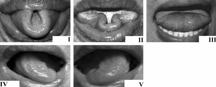 Which of these tongue tricks can you do?