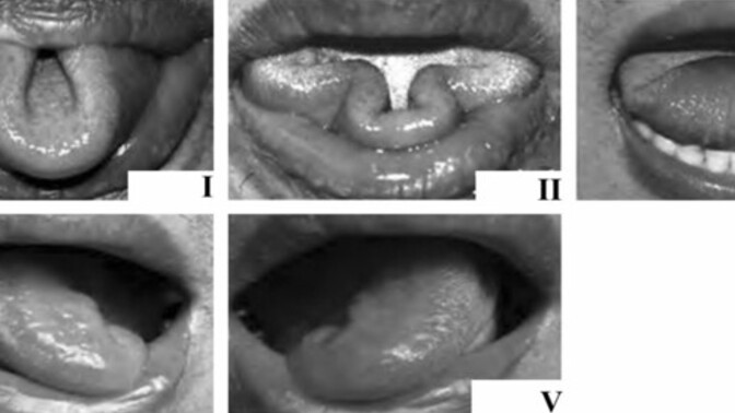 Which of these tongue tricks can you do?