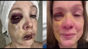 Americans, can you recall a Time you begged a violent mob to beat you to the point of brain damage?