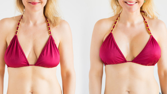 What’s your opinion on women getting breast augmentation because they’ve seen influencers and public figures with larger breasts?